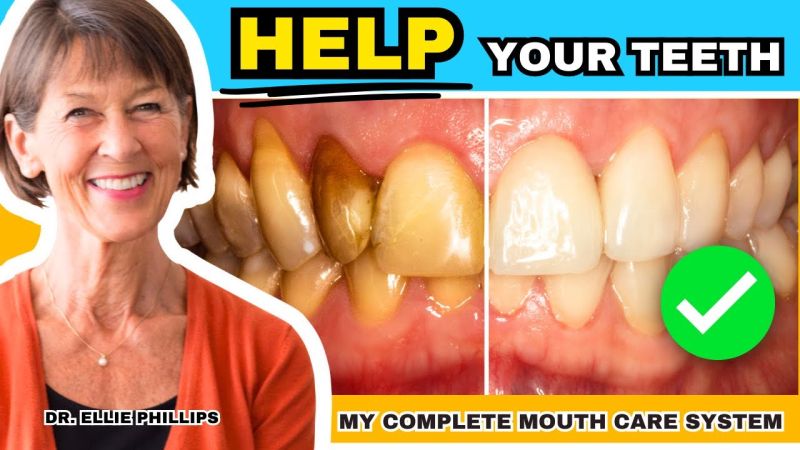 how to create healthy teeth my